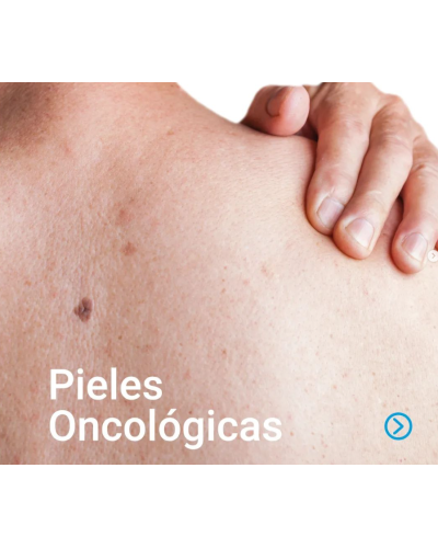 ABZOLEM SOLUCIÓN TÓPICA 30ML