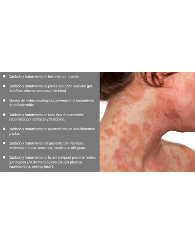 ABZOLEM SOLUCIÓN TÓPICA 30ML
