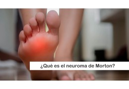 ¿Tienes dolor en el pie? ¿Crees que podrías padecer un neuroma de Morton como la reina Letizia? Descubre más información en nuestro blog