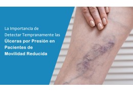 La Importancia de Detectar Tempranamente las Úlceras por Presión en Pacientes de Movilidad Reducida La Importancia de Detectar Tempranamente las Úlceras por Presión en Pacientes de Movilidad Reducida
